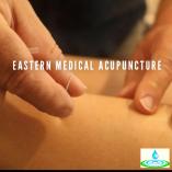 10 x Treatment Package Ocean Shores Acupuncture _small