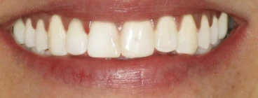 New Patient Offer Kelmscott Dental